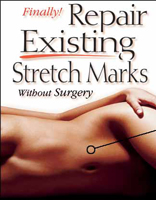 Repair Stretch Marks
