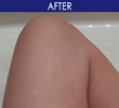 Weight Inches lost - Before & After