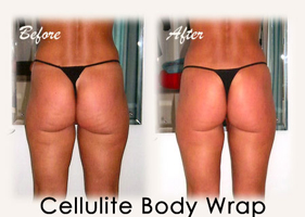 body wrap deluxe kit lose cellulite and inches lose 4 to 25 it works wraps cellulite reviews